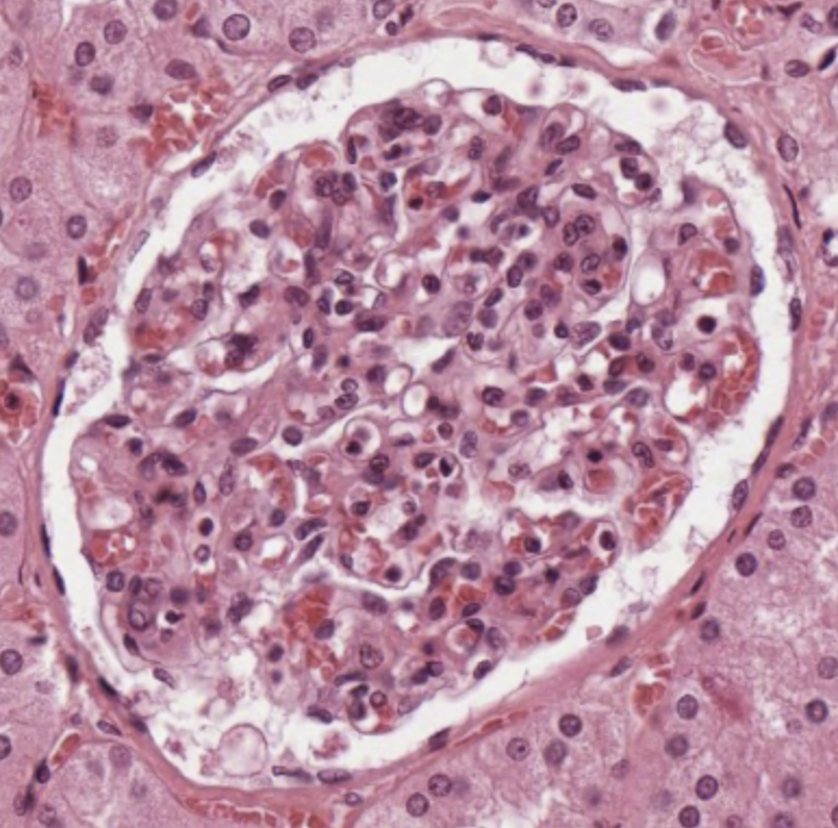 Simple squamous epithelium